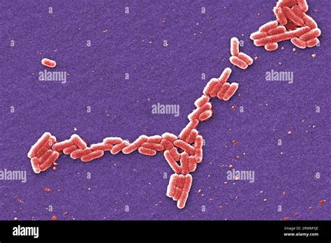  Ischyria: Discover This Sponge with Striking Yellow Hue That Secretes a Powerful Toxin!