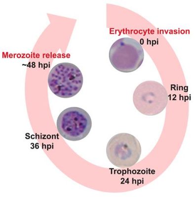 Malaria-Carrying Master of Mutation: Meet the Mysterious Plasmodium Falciparum, the Shape-Shifting Specialist of the Sporozoa Kingdom!